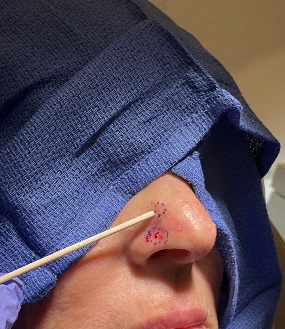 Newport Dermatology & Plastic Surgery
