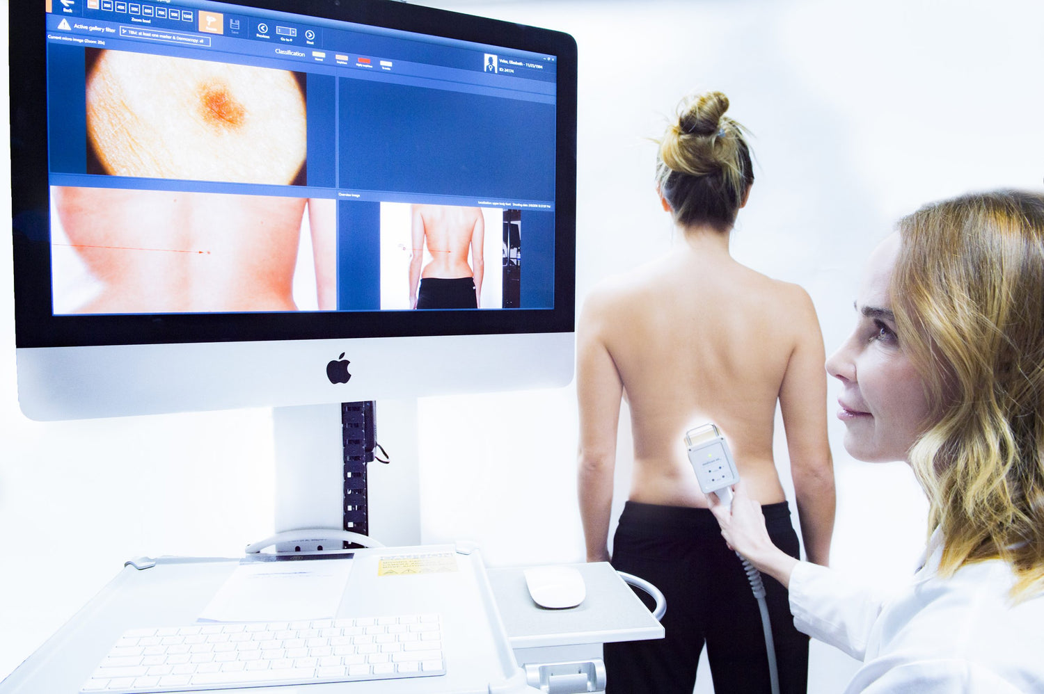 fotofinder mole mapping