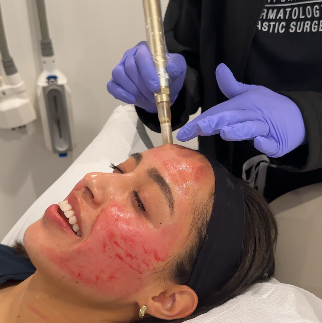 A Guide to Today’s Most Popular Skin Rejuvenation Treatments