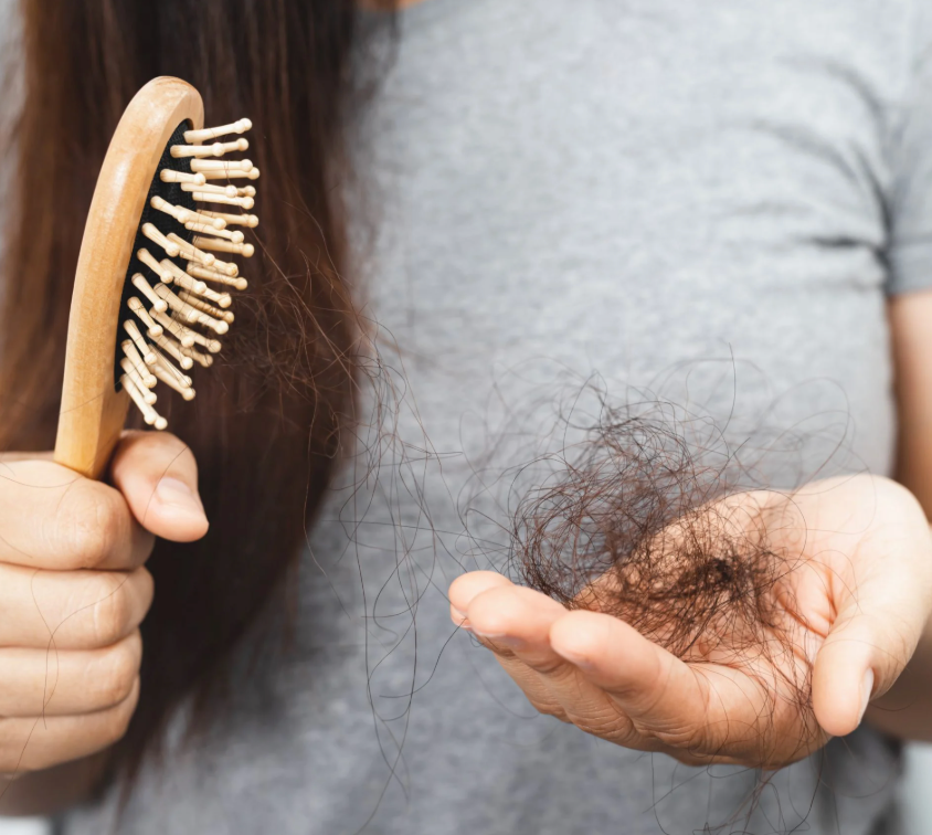 Why Is My Hair Falling Out All of a Sudden?