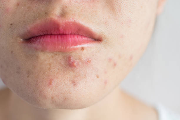 Conceptual of problems on woman skin.