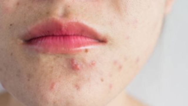 Medical Esthetician Services
