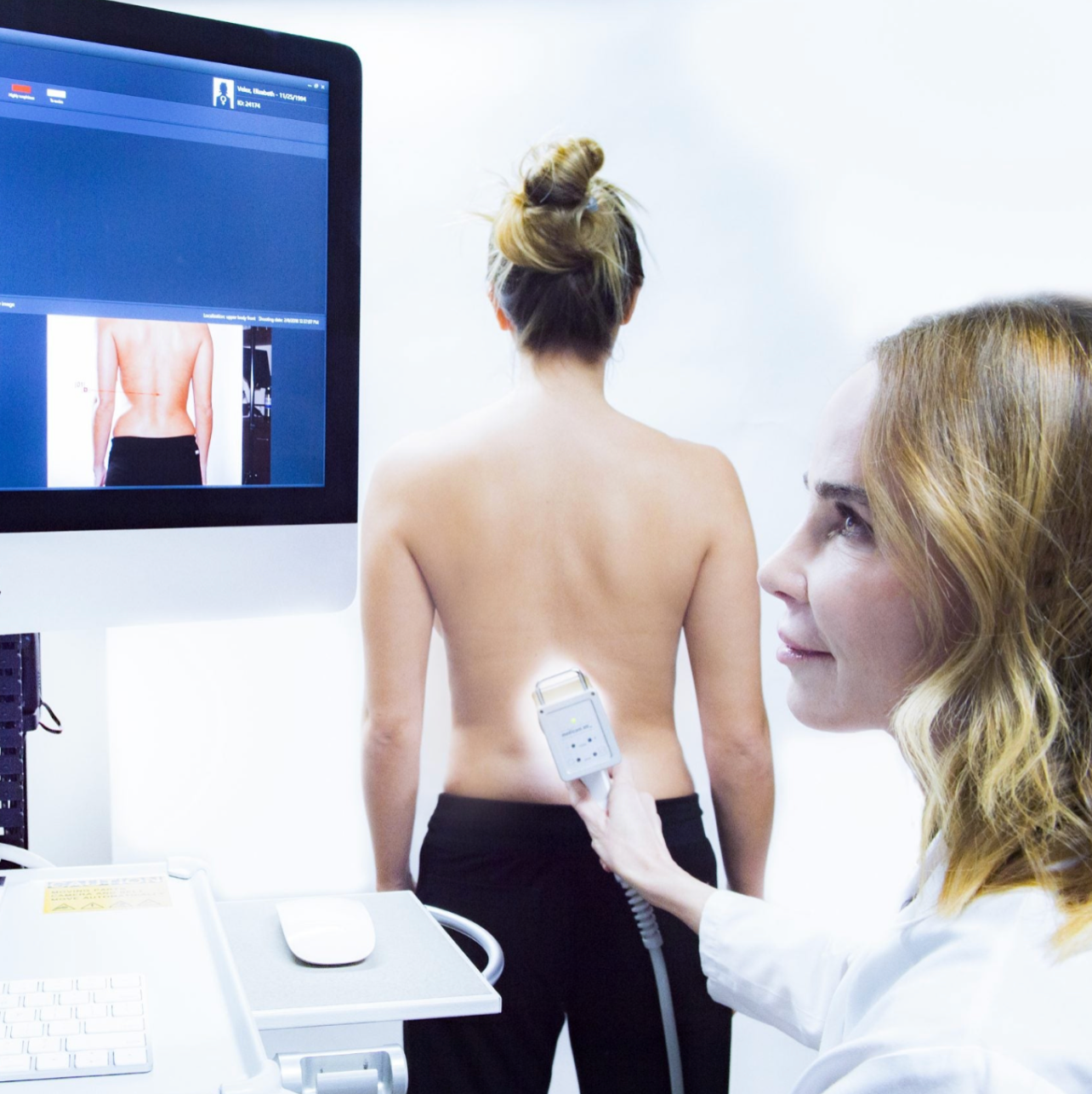 FotoFinder | Early Skin Cancer Detector