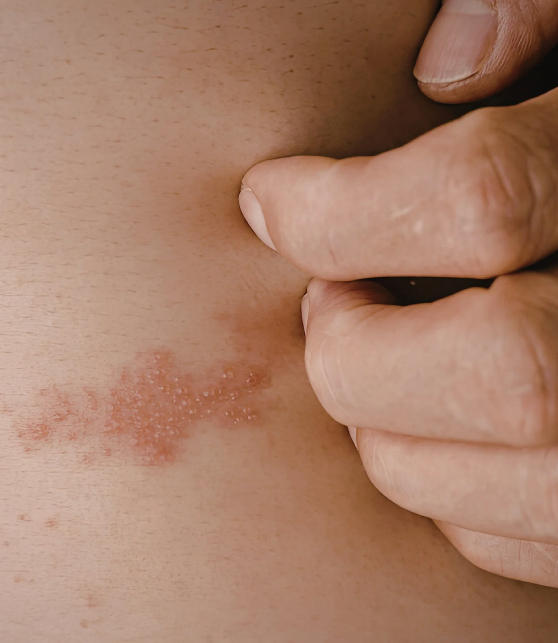 Newport Dermatology & Plastic Surgery