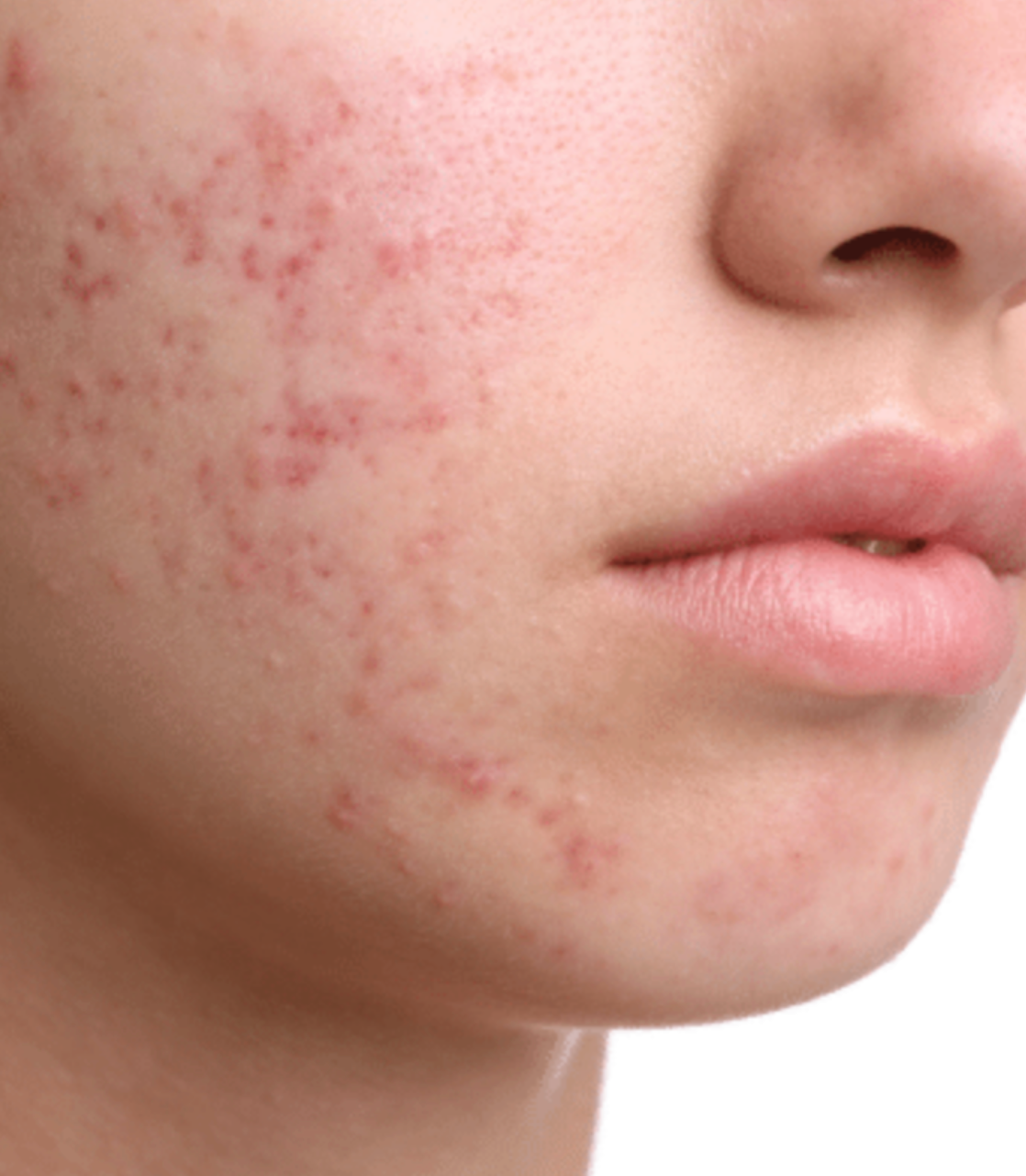 Newport Dermatology & Plastic Surgery