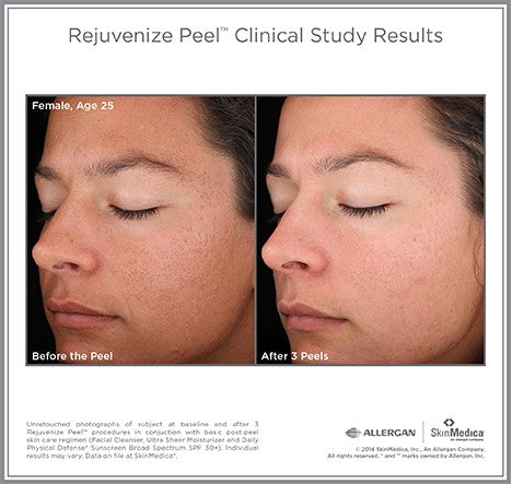 VI Peel ® | Illuminize, Vitalize and Rejuvenize Chemical Peels